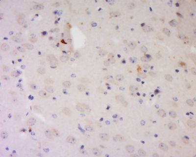 Slit1 Rabbit Polyclonal Antibody