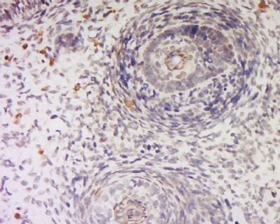Slit1 Rabbit Polyclonal Antibody