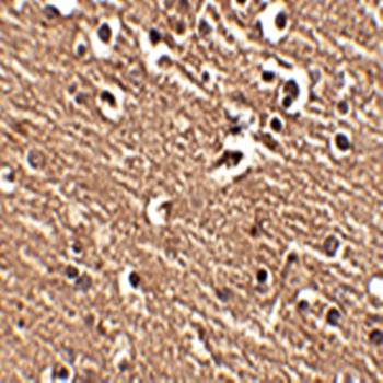 Slitrk1 Rabbit Polyclonal Antibody