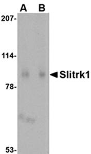 Slitrk1 Rabbit Polyclonal Antibody