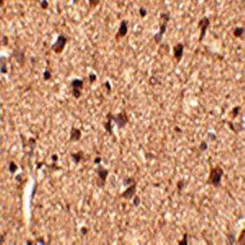 Slitrk1 Rabbit Polyclonal Antibody
