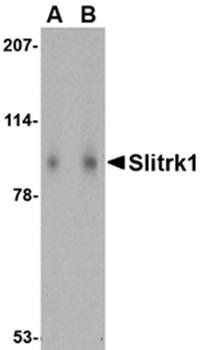 Slitrk1 Rabbit Polyclonal Antibody