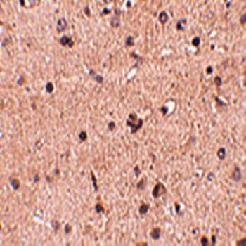 Slitrk2 Rabbit Polyclonal Antibody