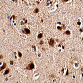 Slitrk5 Rabbit Polyclonal Antibody