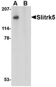 Slitrk5 Rabbit Polyclonal Antibody