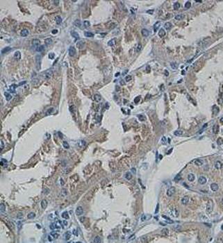Smac/DIABLO Rabbit Polyclonal Antibody