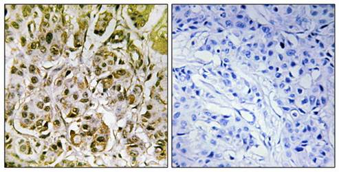 Smad1 (Phospho-Ser187) Antibody