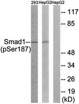 Smad1 (Phospho-Ser187) Antibody