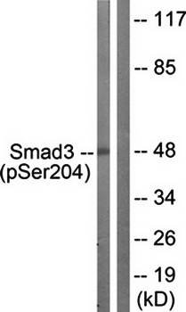 Smad3 (Phospho-Ser204) Antibody