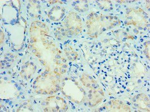 SMAD9 Antibody