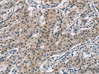 SMAD9 Antibody