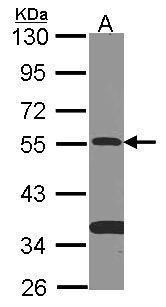 SMAD family member 9 Antibody