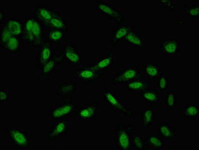 SMARCD1 Antibody