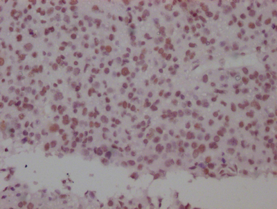 SMC1A Antibody