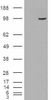 SMEK1/KIAA2010 Antibody