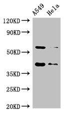 SMN1 Antibody