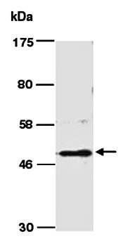 SMYD3 (M) Antibody, Rabbit Polyclonal