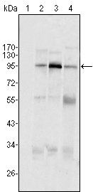 SND1/P100 Antibody