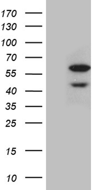 SNRPB2 Antibody