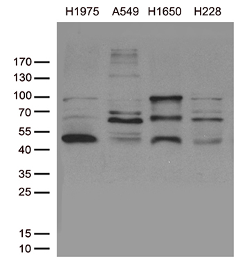 SNRPB2 Antibody