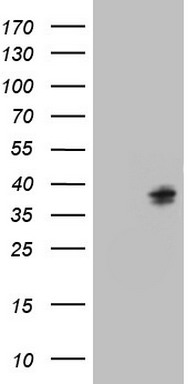 SNRPB2 Antibody
