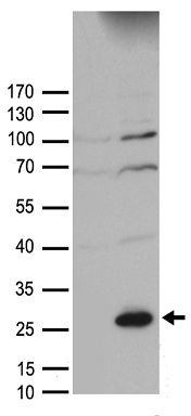 SOCS1 Antibody