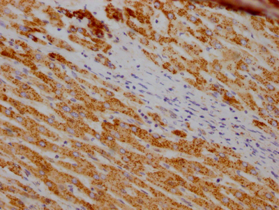 SOD2 Antibody