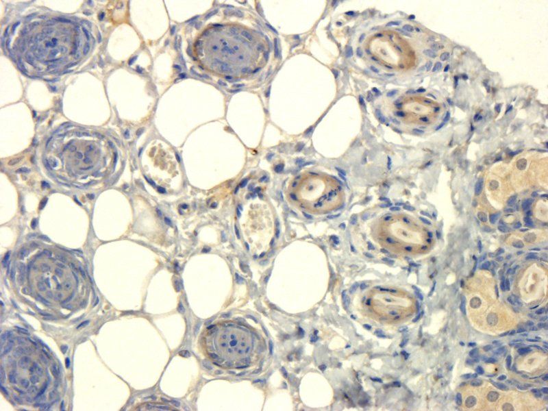 SOD2 Rabbit Polyclonal Antibody