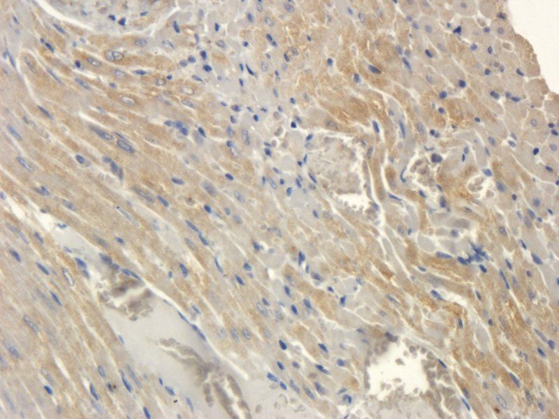 SOD2 Rabbit Polyclonal Antibody
