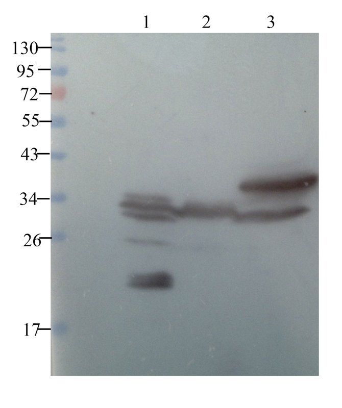SOD2 Rabbit Polyclonal Antibody