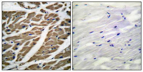 Sodium Channel-pan Antibody