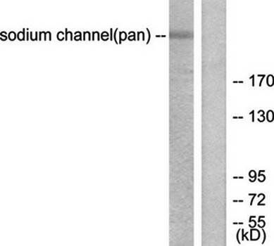 Sodium Channel-pan Antibody