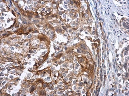 ATPase Na+/K+ transporting subunit beta 3 Antibody