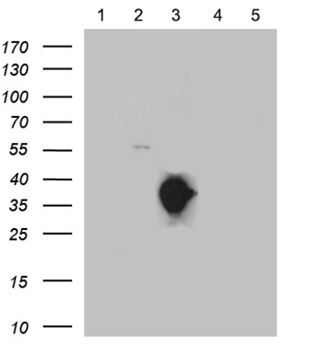 SSTR3 Antibody