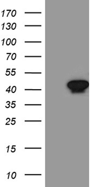 SSTR3 Antibody