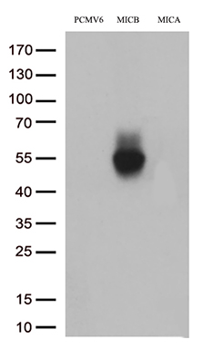 Somatostatin Receptor 3 Antibody