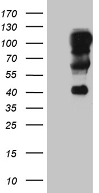Somatostatin Receptor 3 Antibody