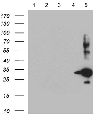 SSTR5 Antibody