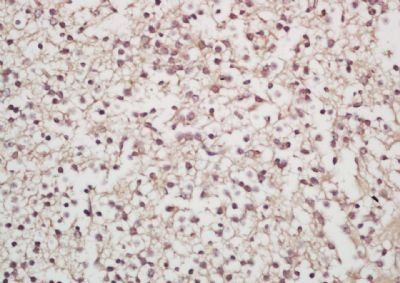 SORCS1 Rabbit Polyclonal Antibody