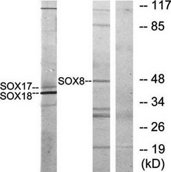 SOX8/9/17/18 Antibody