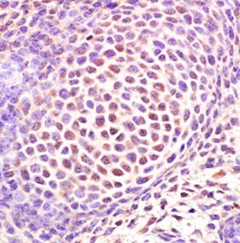 Sp7/Osterix Rabbit Polyclonal Antibody