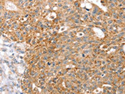 SPARCL1 Antibody