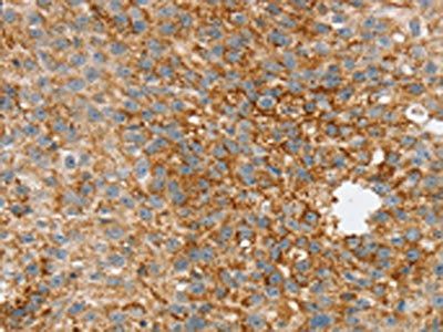SPARCL1 Antibody