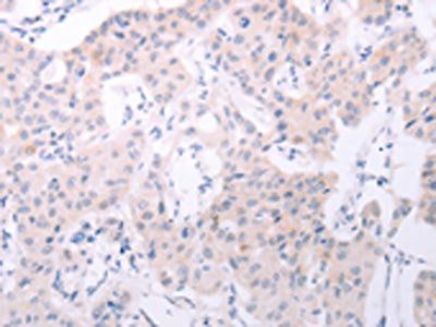 SPATA6 Antibody