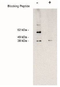 Rabbit Human Sphingosine Kinase 2, Long Form Antibody