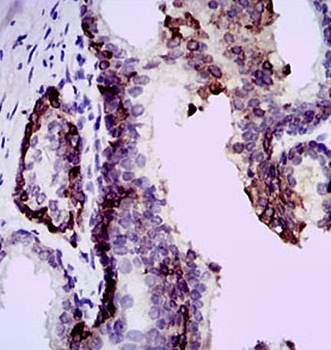 mouse Splunc2 Antibody