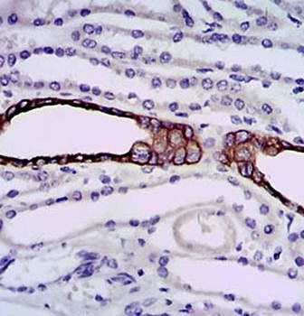 mouse Splunc2 Antibody