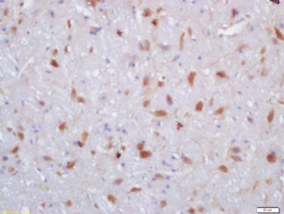 SPNS1 Rabbit Polyclonal Antibody