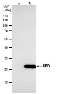 SPR antibody [N2C3]