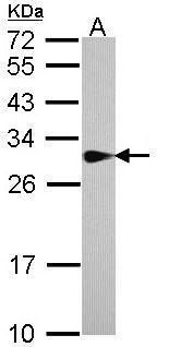 SPR antibody [N2C3]